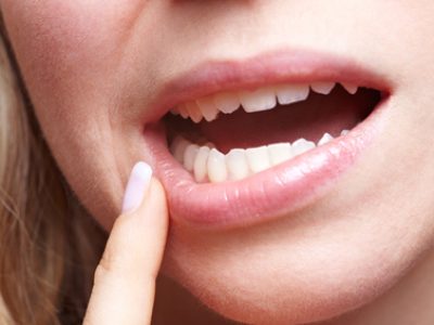 Frau mit Schmerzen am Zahnfleisch hält Finger an den Mund